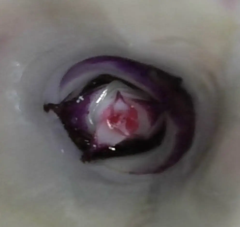 ビルベルギア　成長点　花芽形成初期